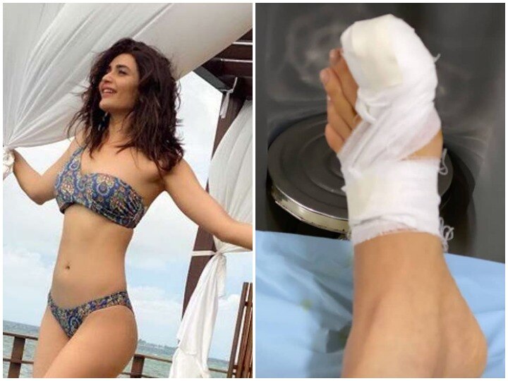 Karishma Tanna toe surgury for ingrown nail amid lockdown लॉकडाउन के बीच करिश्मा तन्ना के पैर के अंगूठे की हुई सर्जरी, तस्वीर शेयर कर दी जानकारी