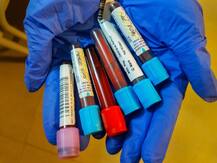 तीन दिन की बच्ची आई थी कोरोना की चपेट में, अब मात देकर लौटी घर