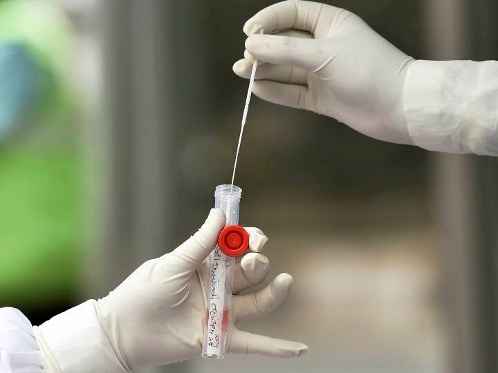 Covid 19: CSIR has prepared a new testing kit, the result will be out in 45 to 60 minutes ANN कोविड 19: CSIR ने बनाई नई टेस्टिंग किट, 45 से 60 मिनट में आ जाएगा रिजल्ट