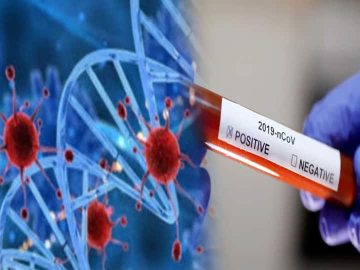 Noida में कोरोना के 6 नए केस, संक्रमितों की संख्या बढ़कर 230 हुई One died and Six new coronavirus cases found in noida Noida में कोरोना के 6 नए केस, संक्रमितों की संख्या बढ़कर 230 हुई