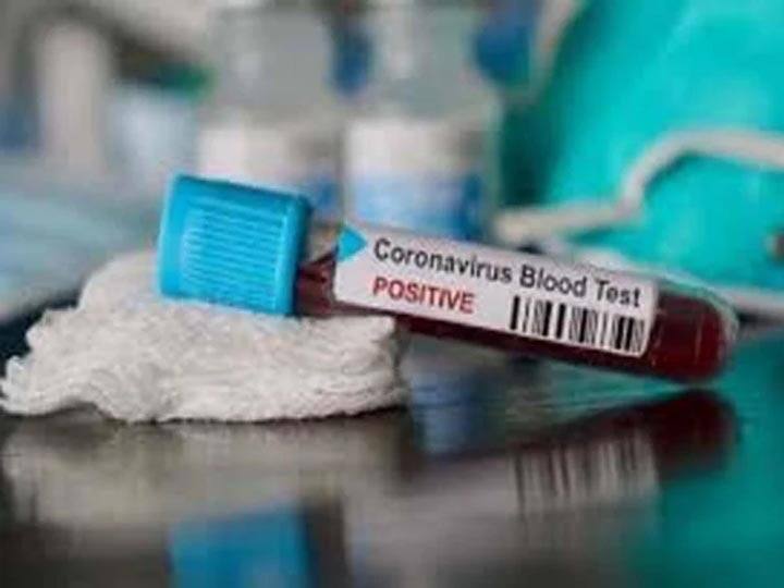 जालौन: हॉट स्पॉट एरिया से मिले 6 संक्रमित मरीज, तीन सब्जी विक्रेता कोरोना पॉजिटिव मिलने के बाद मंडी बंद Corona patient increases rapidly in Jalaun Uttar pradesh जालौन: हॉट स्पॉट एरिया से मिले 6 संक्रमित मरीज, तीन सब्जी विक्रेता कोरोना पॉजिटिव मिलने के बाद मंडी बंद