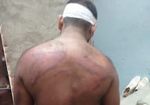 ग्रेटर नोएडा: युवक के साथ दबंगों का अमानवीय व्यवहार, दूध ले जाने से इंकार पर बुरी तरह की पिटाई