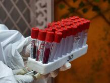 दिल्ली में शुरू हुआ प्लाज्मा बैंक, कैसे करेंगे काम और कौन कर सकता है दान, जानें