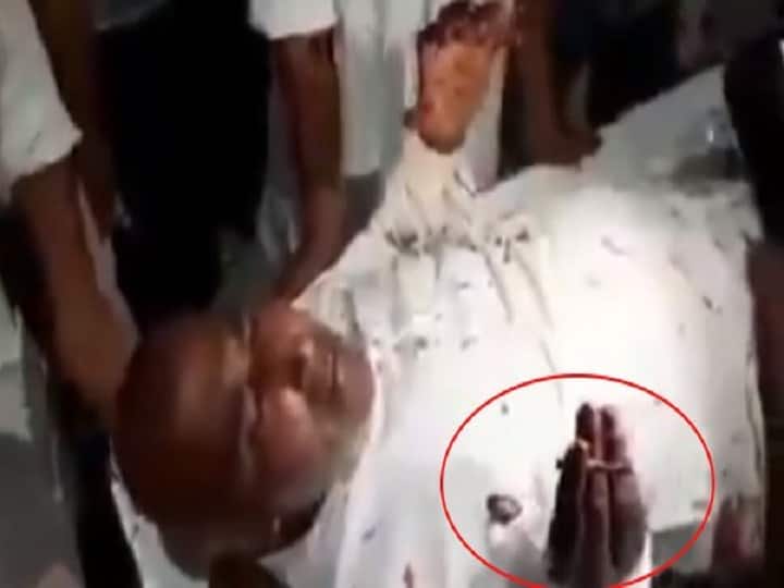 Viral Video: गोली लगने के बावजूद स्ट्रेचर पर बीड़ी पीता रहा शख्स, आप भी देखें A man kept smoking a beedi on a stretcher despite being shot Viral Video: गोली लगने के बावजूद स्ट्रेचर पर बीड़ी पीता रहा शख्स, आप भी देखें
