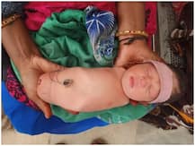 मध्य प्रदेशः बिना हाथ और पैर के जन्मी बच्ची, डॉक्टर ने कहा- लाखों में किसी एक को होती है यह बीमारी
