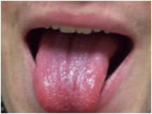 5 गंदी आदतें जो जीभ को बना सकती हैं काला, जानें इससे बचने के उपाय