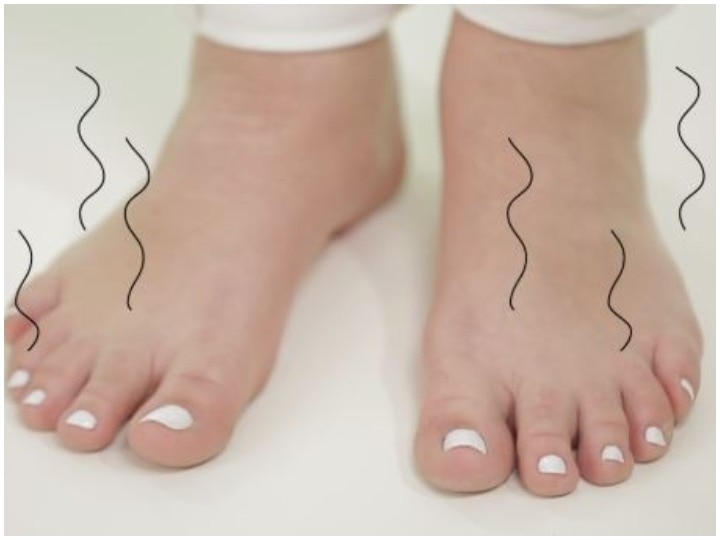 How To Get Rid of Smelly Feet Best Ways to Fix It गर्मियों में पैरों से आती बदबू कहीं आपका मजाक न बनवा दे, इन 5 उपायों से पाएं छुटकारा