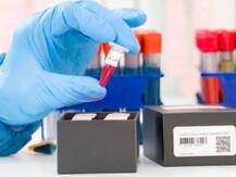 दिल्ली में देश का सबसे बड़ा सीरो सर्वे, स्वास्थ्य मंत्री बोले- कोरोना के खिलाफ हर्ड इम्युनिटी की ओर बढ़ रही है राजधानी