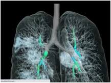 फेफड़े बिना रुके निरंतर करते हैं काम, सेब, मिर्च और चुकंदर का इस्तेमाल कर ले सकते हैं ये लाभ