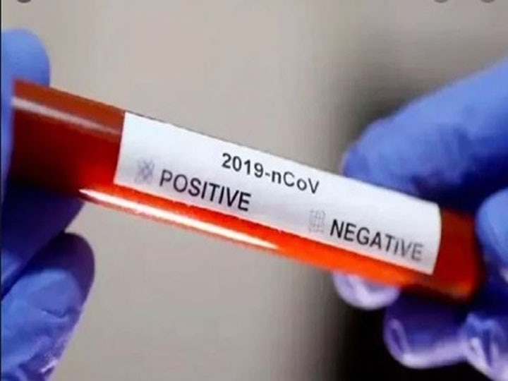 More than 2 crore tests of Coronavirus conducted in country so far ANN देश में अब तक हुए कोरोना के 2 करोड़ से ज्यादा टेस्ट, पिछले 24 घंटों में करीब 4 लाख नमूनों की हुई जांच