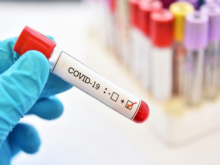 53 people died in 24 hours due to coronavirus infection in uttar pradesh यूपी में बढ़ रहा है कोरोना महामारी का प्रकोप, 24 घंटों में 53 लोगों की हुई मौत