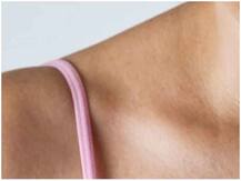 रेडियोथेरेपी के जरिए जल्द ठीक हो सकता है स्तन कैंसर- अध्ययन