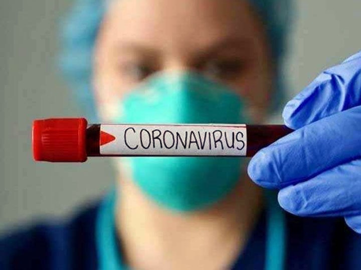 70 people died in 24 hours due to coronavirus infection in uttar pradesh यूपी में बढ़ रहा है कोरोना महामारी का प्रकोप, 24 घंटों में 70 लोगों की हुई मौत