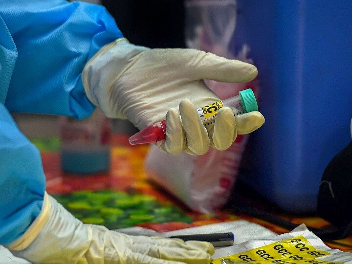 Chinese vaccine maker Sinopharm seeks government regulatory approval to market Covid-19 shots अमेरिका के बाद अब चीन ने भी कोरोना वैक्सीन के इस्तेमाल की सरकार से मांगी इजाजत