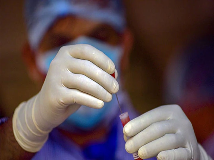 यूपी में लगातार बढ़ रहा है कोरोना वायरस का संक्रमण, 24 घंटों में 61 लोगों की हुई मौत