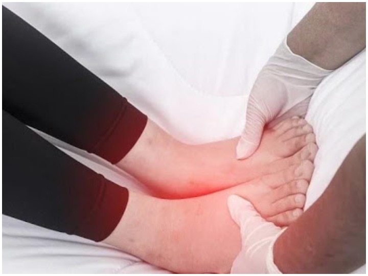 अंगुलियों या पैरों के पंजों में सूजन हो सकता है इस जानलेवा बीमारी का संकेत, भूलकर भी नहीं करें...-Swelling in the fingers or toes can be a sign of this deadly disease, do not do it even by mistake.