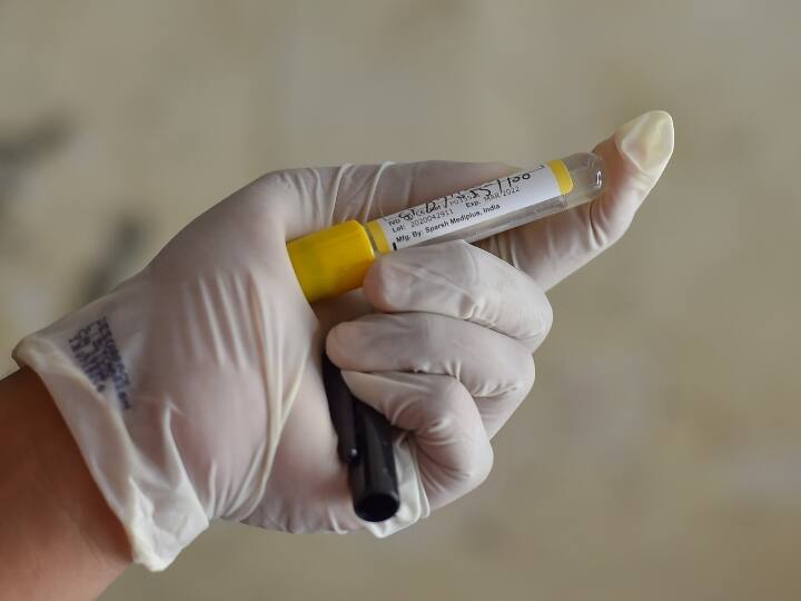 COVID 19: अब तक एक्टिव केस से 3.5 गुणा ज्यादा मरीज रिकवर, कल एक दिन में सबसे ज्यादा लोग ठीक हुए Coronavirus number of recovered cases is 3.5 times more than active cases COVID 19: अब तक एक्टिव केस से 3.5 गुणा ज्यादा मरीज रिकवर, कल एक दिन में सबसे ज्यादा लोग ठीक हुए