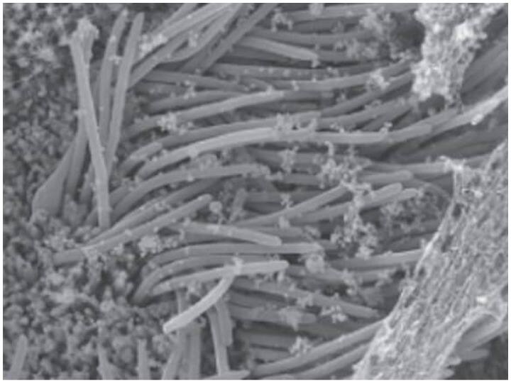 पहली बार कोरोना वायरस से संक्रमित कोशिकाओं की तस्वीर आई सामने, मास्क पहनने की बताई अहमियत First images of Covid-19 infected cells appeared, show strong case for masks to limit transmission पहली बार कोरोना वायरस से संक्रमित कोशिकाओं की तस्वीर आई सामने, मास्क पहनने की बताई अहमियत