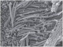 पहली बार कोरोना वायरस से संक्रमित कोशिकाओं की तस्वीर आई सामने, मास्क पहनने की बताई अहमियत