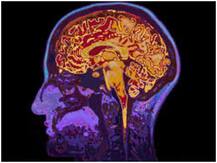 Alzheimer Day 2020: बीमारी का क्या है कारण, लक्षण और बचाव के एहतियाती उपाय, जानिए परिवार की भूमिका