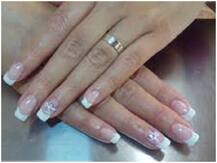 आपके नाखून शरीर के स्वास्थ्य का बताते हैं पता, संकेतों को गंभीर समस्या में बदलने से पहले पहचानें