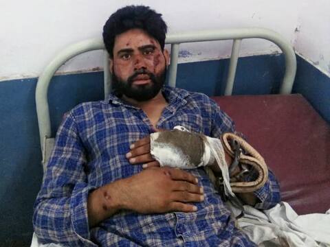सहारनपुरः बदमाशों और पुलिस की मुठभेड़, एक गिरफ्तार, दूसरा फरार सहारनपुरः बदमाशों और पुलिस की मुठभेड़, एक गिरफ्तार, दूसरा फरार
