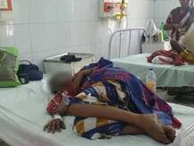 यूपी के गोंडा में सोते समय तीन दलित बहनों पर एसिड अटैक, तीनों झुलसीं, एक की हालत गंभीर