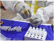 30 मिनट में कोविड-19 टेस्ट किट दे सकता है नतीजा, 2-3 हफ्तों में भारत और इजराइल जल्द लॉन्च करने की तैयारी में