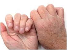 सर्दी में हाथ सूखने, स्किन झड़ने की समस्या से क्या आप होते हैं परेशान? ये टिप्स आपके लिए हो सकते हैं मुफीद