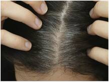 Tips: बालों की खुश्की को इस तरह करें दूर, महंगे प्रोडक्ट्स खरीदने की नहीं पड़ेगी जरूरत