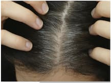 सर्दी के मौसम में सिर और त्वचा से खुश्की कैसे की जाए खत्म? जानिए आसान और सरल टिप्स