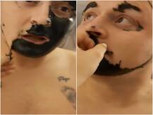 स्कॉटलैंड: गोरा दिखने के लिए एक शख्स ने चेहरे पर लगाया था ब्लैक चारकोल, आईब्रो भी हो गई साफ, देखें वायरल वीडियो