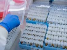 WHO के बाद AstraZeneca वैक्सीन को EU ने बताया सुरक्षित, कहा- खून का थक्का जमने का खतरा नहीं