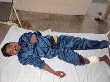 बागपत: पुलिस मुठभेड़ में 25 हजार का इनामी बदमाश धरा गया, महिला की हत्या में वांछित चल रहा था