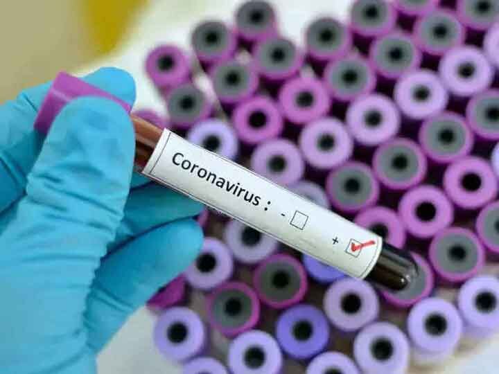 1,617 new cases of corona reported in Delhi in last one day, infection rate below 2 percent दिल्ली में बीते एक दिन में सामने आए कोरोना के 1,617 नए मामले, दो प्रतिशत से नीचे हुई संक्रमण दर