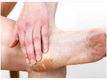 Winter care: सर्दी के मौसम में हाथ-पैर की देखभाल है खास, स्किन की खूबसूरती बढ़ाने के लिए ऐसे बनाएं लोशन