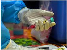 Corona Vaccine Dry Run: जम्मू कश्मीर के 3 जिलों के 10 अलग अस्पतालों में कोरोना वैक्सीन का ड्राई रन