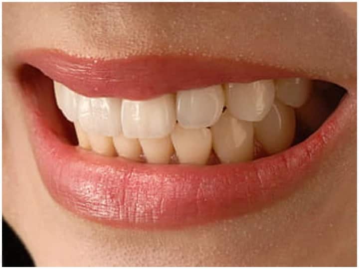 Teeth Care: दांतों की समस्याओं में कारगर हैं ये 8 देसी नुस्खे, दुर्गंध और पीलापन दूर कर बनाएंगे चमकदार Teeth Care: Try these home remedies for teeth care Teeth Care: दांतों की समस्याओं में कारगर हैं ये 8 देसी नुस्खे, दुर्गंध और पीलापन दूर कर बनाएंगे चमकदार