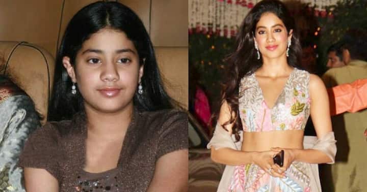 23 साल की जान्हवी कपूर कभी ऐसी नज़र आती थीं. कहा जाता है कि बॉलीवुड में एंट्री से पहले वह भी विदेश से सर्जरी करवाकर आई थीं. इस तस्वीर में आप उनके चेहरे पर फर्क साफ देख सकते हैं. 