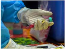 Covid-19 vaccine: जॉनसन एंड जॉनसन की सिंगल डोज वैक्सीन शुरुआती मानव परीक्षण में कारगर