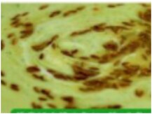 Raita Recipe Tip: क्या आपने बथुआ के रायता का स्वाद चखा है? जानिए- बनाने की आसान और झटपट रेसिपी