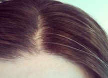 Health Tips: सफेद बालों से निजात पाने के लिए अपनाएं ये घरेलू नुस्खे