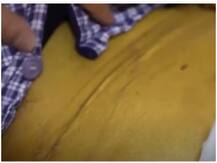 भयानकः स्मोकिंग आपकी स्किन के साथ क्या कर सकती है ये वीडियो देखकर आप सहम जाएंगे