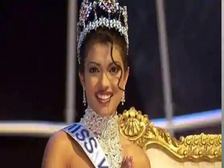 Priyanka Chopra was burnt on the day of Miss World event Priyanka Chopra जल गई थी मिस वर्ल्ड इवेंट वाले दिन, कहा- किसी ने मुझे दिया था धक्का