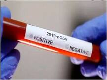 ब्लड ग्रुप कोविड-19 संक्रमण के प्रति क्यों खास महत्व रखता है? रिसर्च में सामने आई ये चौंकाने वाली बात