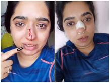 महिला ने कैंसल किया Zomato ऑर्डर तो डिलिवरी ब्वॉय ने मारा घूंसा, देखें वायरल वीडियो