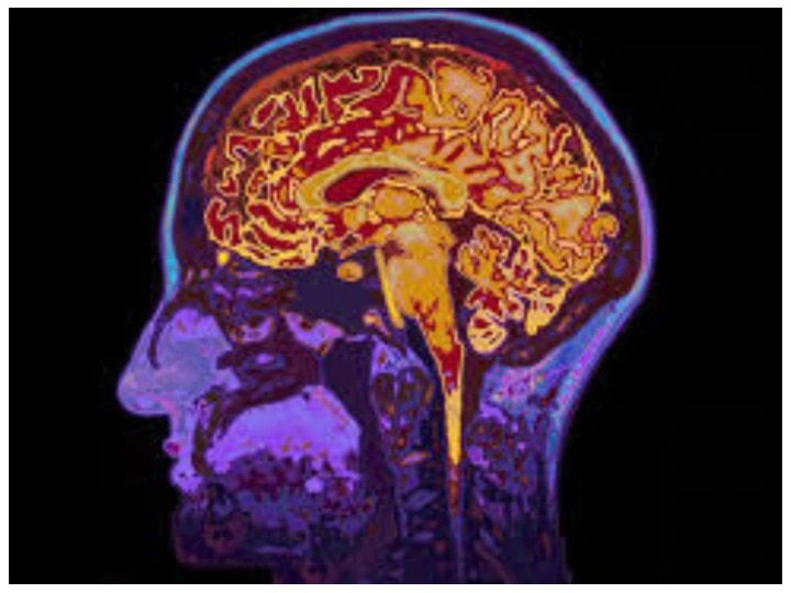 Alzheimer's and Dementia are linked to memory problems, help affected by differentiating अल्जाइमर-डिमेंशिया: बुढ़ापे में अभिशाप की तरह हैं यह बीमारियां, इस तरह करें पीड़ितों की मदद