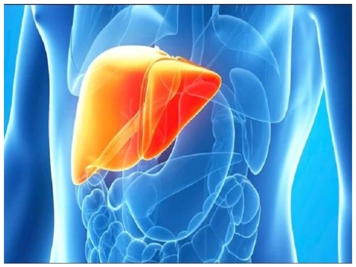 Fatty liver: Symptoms, signs and causes, knowing will save you from liver complications Fatty Liver Disease: जानिए संकेत, लक्षण और कारण, वक्त रहते फैटी लीवर को बनाएं स्वस्थ जिससे ना हो भविष्य में दिक्कत