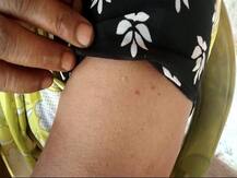 मजाक बना वैक्सीनेशन, फोन पर बात करते हुये नर्स ने महिला को दो बार लगा दिया कोरोना का टीका