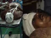 হাড়োয়ায় ঘরে ফেরা সিপিএম কর্মীর ওপর ‘হামলা’ তৃণমূলের